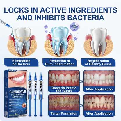 👨‍⚕️👨‍⚕️🦷❄️Solaroza® Gum Revive periodontal repair gel