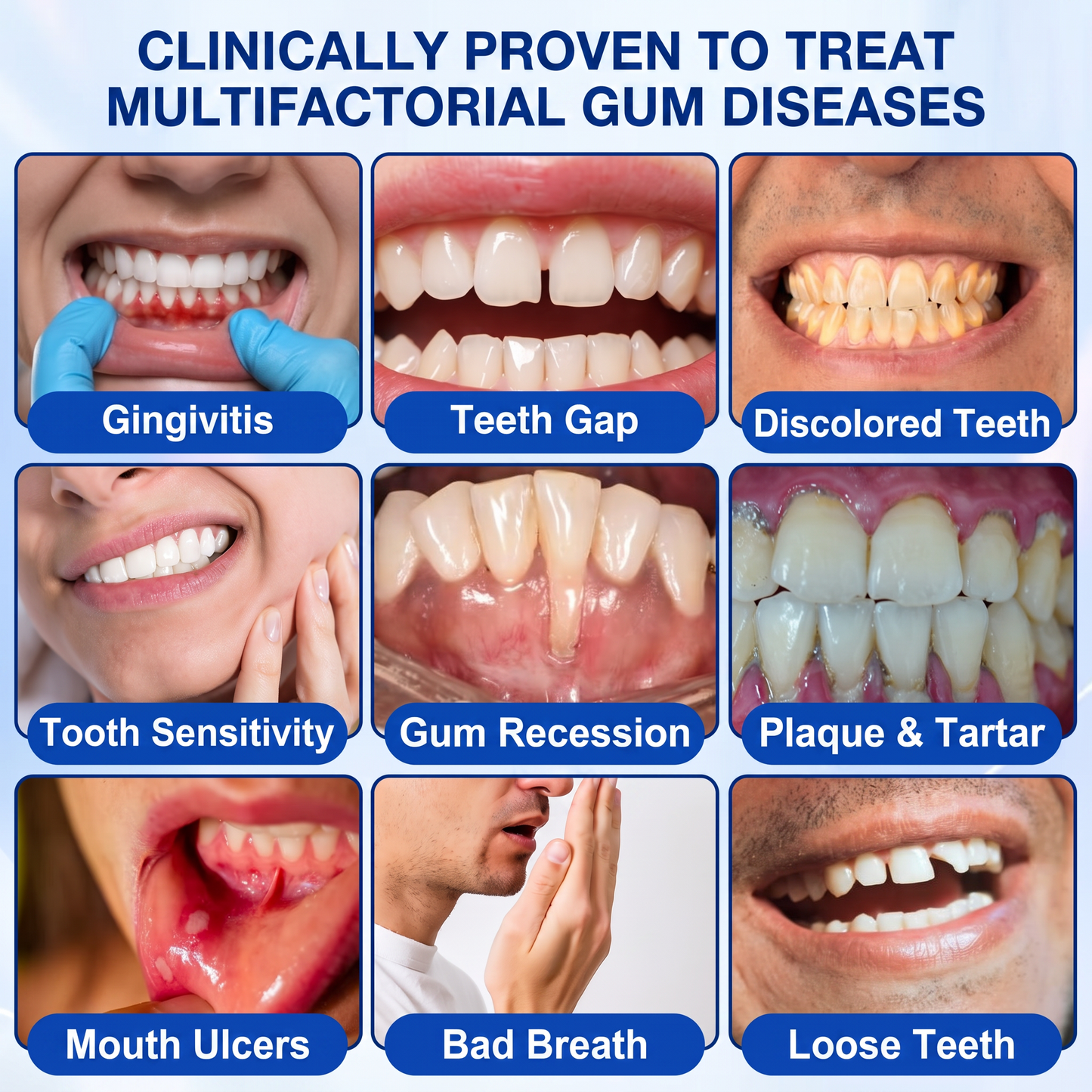 👨‍⚕️👨‍⚕️🦷❄️Solaroza® Gum Revive periodontal repair gel