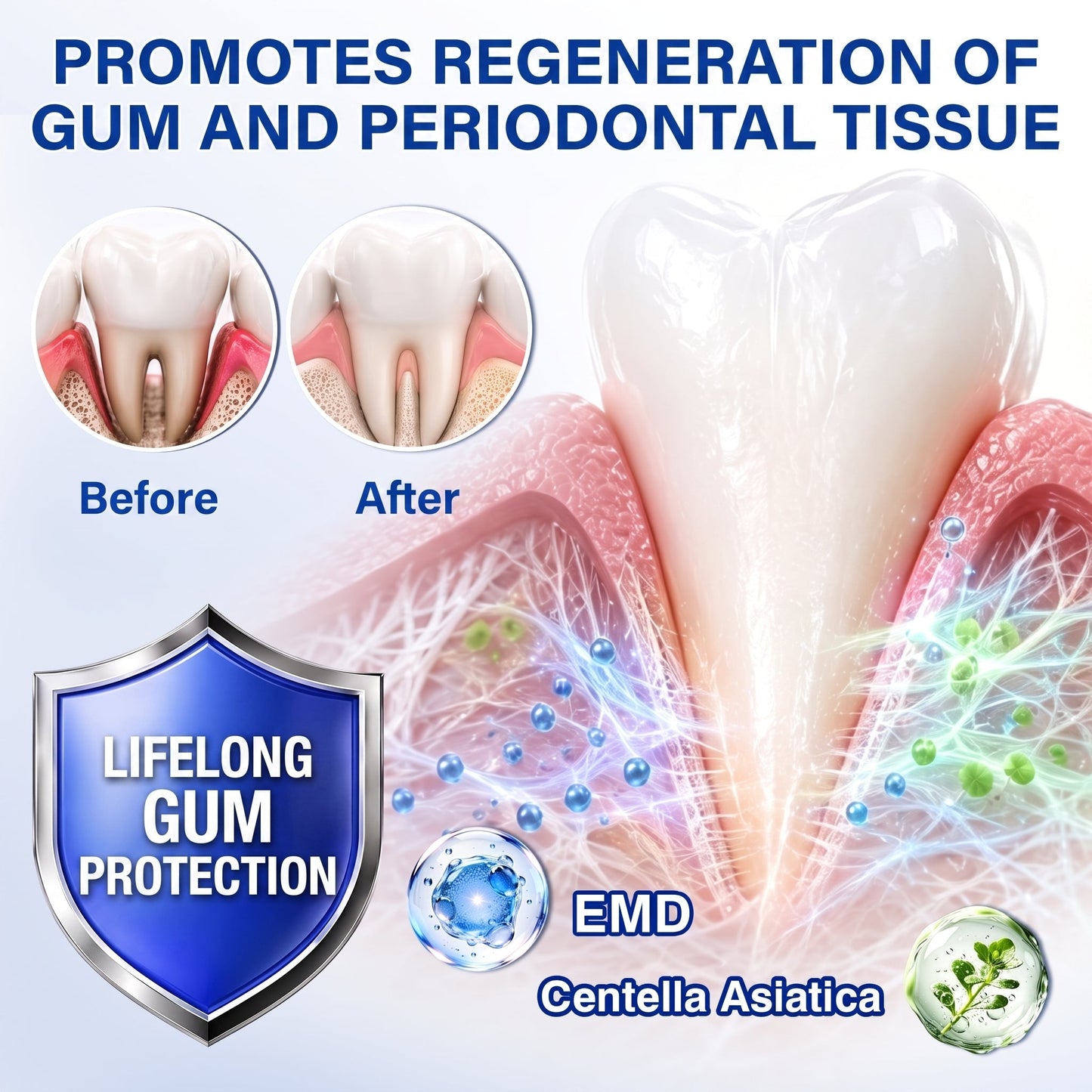 👨‍⚕️👨‍⚕️🦷❄️Solaroza® Gum Revive periodontal repair gel