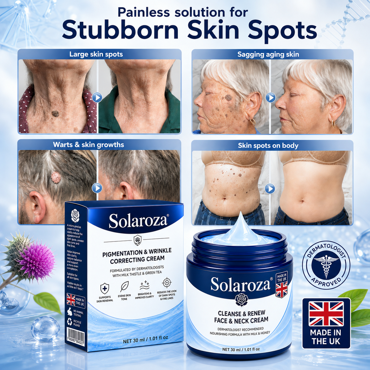 💧𝐒𝐨𝐥𝐚𝐫𝐨𝐳𝐚® 7-Day Skin Tag & Pigmentation Removal Cream (Painless Formula – Scar-Free) 🇬🇧