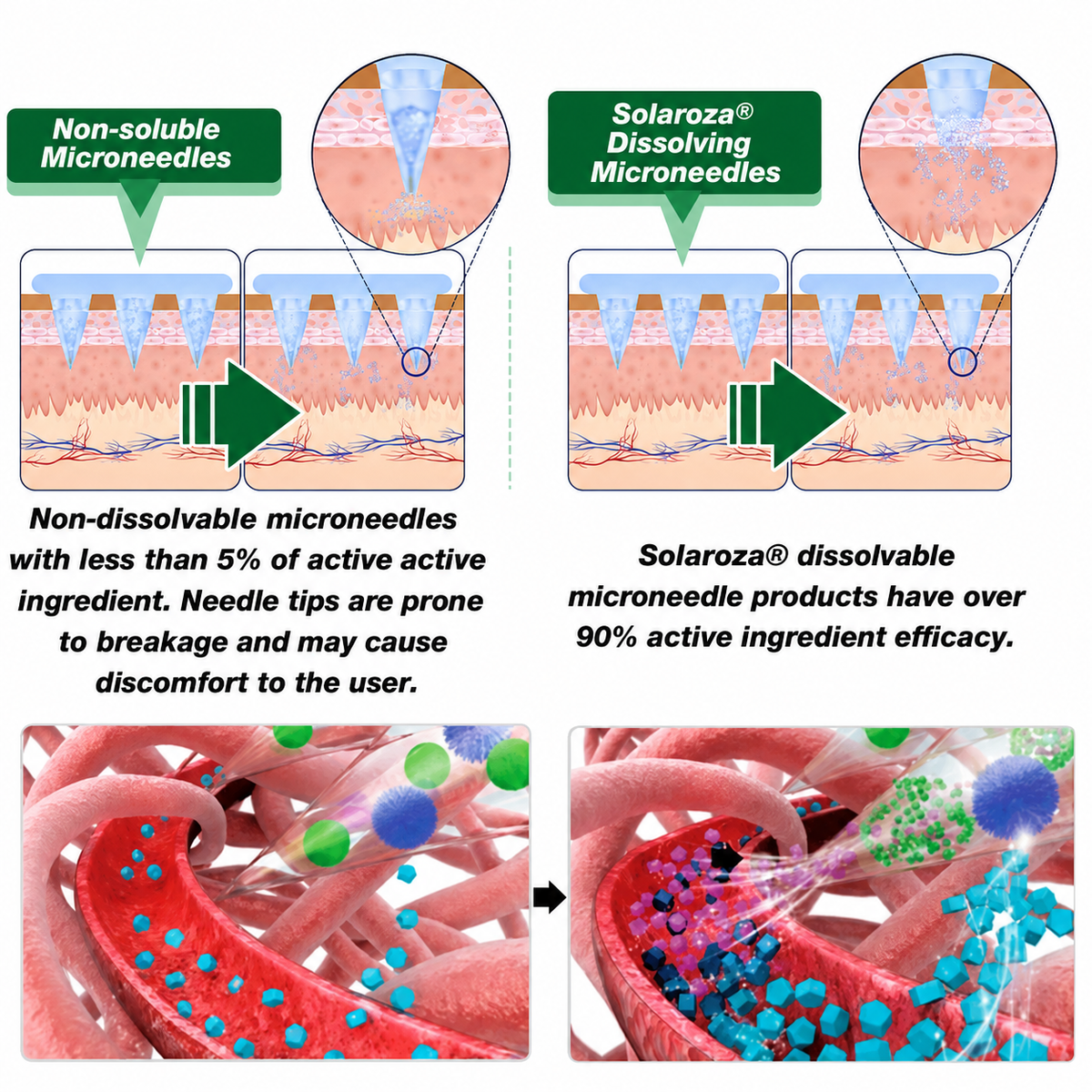 ✅Official Store | 🏆 Solaroza® Moringa & Berberine 15-IN-1 Advanced Nano Microneedle Patch (Once Daily, visible changes in 7 days) ✅ Obesity, Diabetes, Sleep Apnea, And Joint Issues