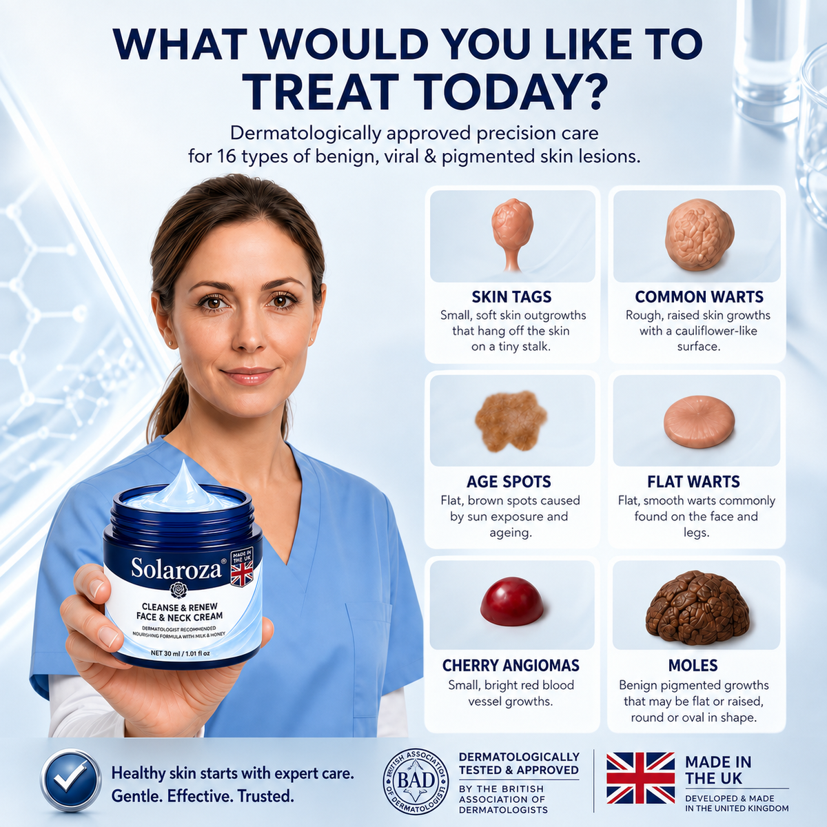 💧𝐒𝐨𝐥𝐚𝐫𝐨𝐳𝐚® 7-Day Skin Tag & Pigmentation Removal Cream (Painless Formula – Scar-Free) 🇬🇧